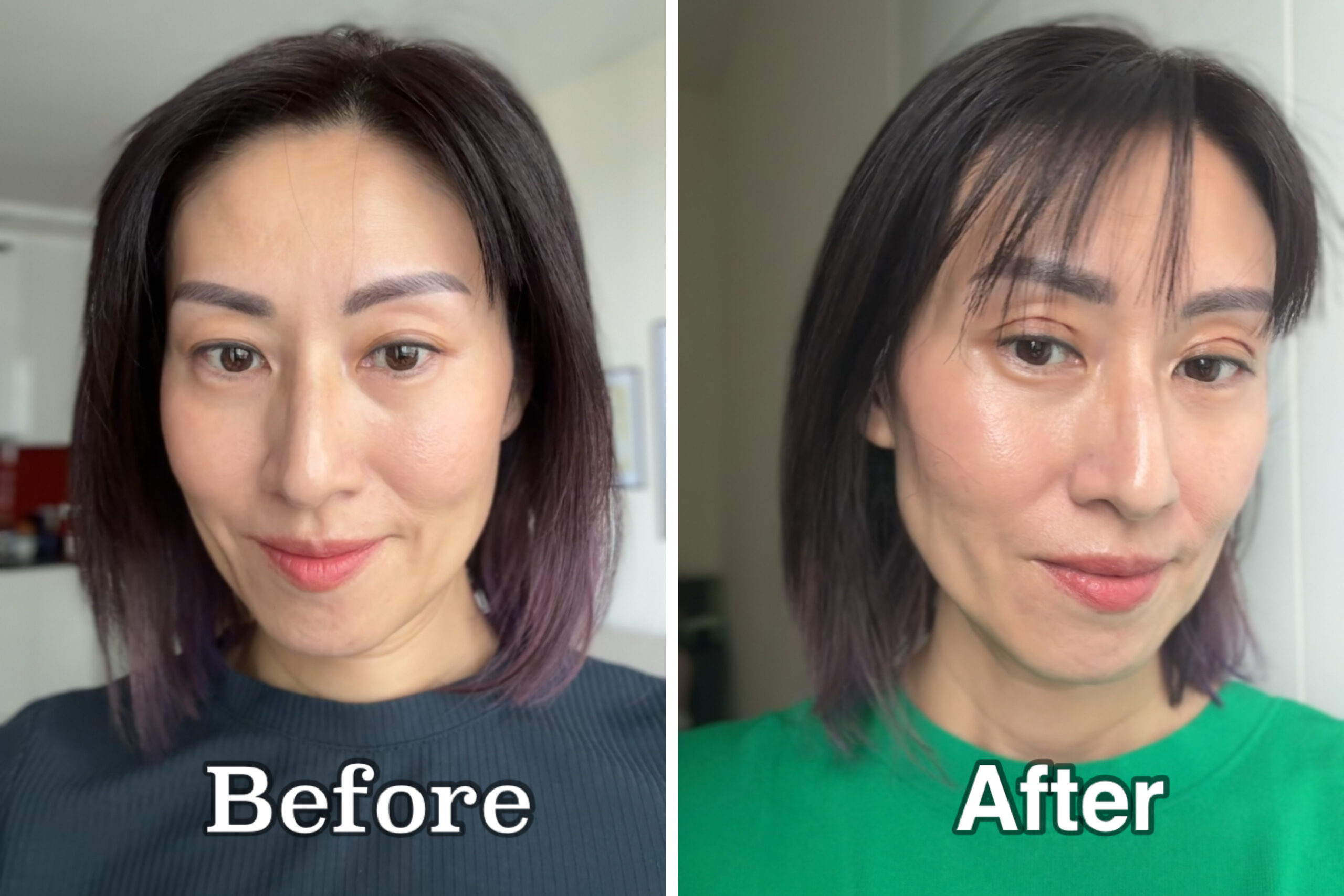 Before & After DST Procedure